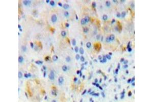 Used in DAB staining on fromalin fixed paraffin-embedded Liver tissue (Oncostatin M Receptor 抗体  (AA 503-749))