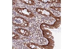 Immunohistochemical staining of human rectum with LEKR1 polyclonal antibody  shows strong cytoplasmic positivity in glandular cells at 1:1000-1:2500 dilution. (LEKR1 抗体)