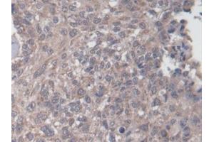Immunohistochemistry (IHC) image for anti-N-Acetylglucosaminidase, alpha (NAGLU) (AA 485-743) antibody (ABIN7435373)