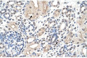 Rabbit Anti-NCL Antibody Catalog Number: ARP40583 Paraffin Embedded Tissue: Human Kidney Cellular Data: Epithelial cells of renal tubule Antibody Concentration: 4. (Nucleolin 抗体  (N-Term))