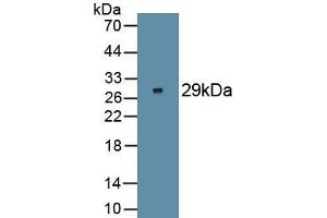 Detection of Recombinant FOXP3, Human using Monoclonal Antibody to Forkhead Box P3 (FOXP3) (FOXP3 抗体  (AA 191-412))