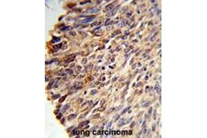 Immunohistochemistry (Paraffin-embedded Sections) (IHC (p)) image for anti-B-Cell CLL/lymphoma 3 (BCL3) (AA 248-277), (Middle Region) antibody (ABIN950634)