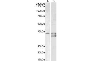 ABIN6391386 (1ug/ml) staining of PD19 (A) and (2µg/ml) K562 (B) cell lysate (35µg protein in RIPA buffer). (SGTA 抗体  (AA 84-97))