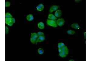 Immunofluorescence staining of MCF-7 cells with ABIN7144753 at 1:200, counter-stained with DAPI. (Aspartyl Aminopeptidase 抗体  (AA 279-386))