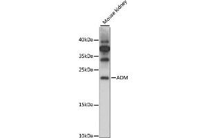 Western blot analysis of extracts of Mouse kidney, using ADM antibody (ABIN7265507) at 1:1000 dilution. (Adrenomedullin 抗体  (AA 50-150))
