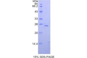 SDS-PAGE analysis of Human SIGLEC1 Protein. (Sialoadhesin/CD169 蛋白)