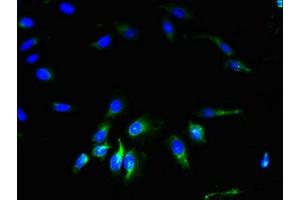 Immunofluorescent analysis of Hela cells using ABIN7153593 at dilution of 1:100 and Alexa Fluor 488-congugated AffiniPure Goat Anti-Rabbit IgG(H+L) (GJA4 抗体  (AA 231-333))