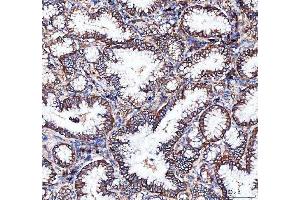 IHC analysis of Integrin alpha 3/ITGA3 using anti-Integrin alpha 3/ITGA3 antibody (ABIN7602696). (ITGA3 抗体  (AA 96-324))