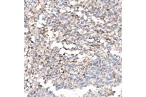 Immunohistochemistry of paraffin-embedded human tonsil using Survivin Rabbit pAb (ABIN6132229, ABIN6137562, ABIN6137563 and ABIN6218613) at dilution of 1:100 (40x lens).