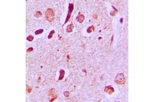 Immunohistochemical analysis of JIP3 staining in human brain formalin fixed paraffin embedded tissue section. (JIP3 抗体  (Center))