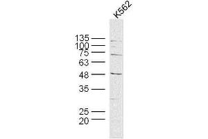 Human K562 cells probed with MAGEB6 Polyclonal Antibody, unconjugated  at 1:300 overnight at 4°C followed by a conjugated secondary antibody at 1:10000 for 90 minutes at 37°C. (MAGEB6 抗体  (AA 151-250))