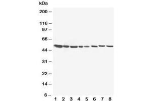 Western blot testing of 17-beta-Hydroxysteroid dehydrogenase 4 antibody and Lane 1:  rat liver;  2: (r) brain;  3: (r) testis;  4: (r) small intestine;  5: human SMMC-7721;  6: (h) HeLa;  7: (h) U87;  8: (h) COLO320 (HSD17B4 抗体  (C-Term))
