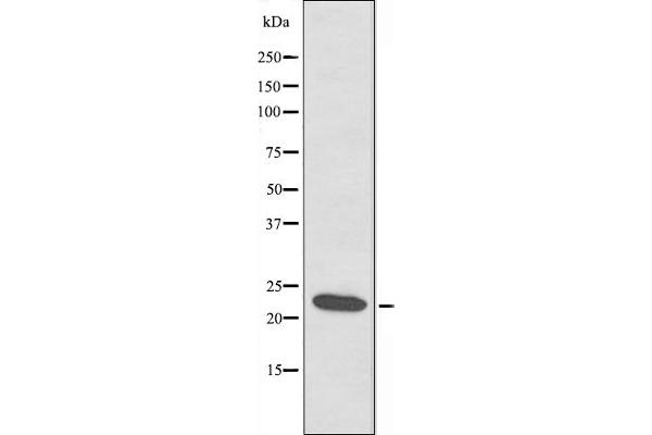 ATP5S 抗体  (Internal Region)