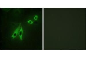 Immunofluorescence analysis of NIH/3T3 cells, using AKAP3 antibody. (AKAP3 抗体  (Internal Region))