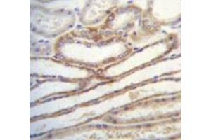 Immunohistochemistry analysis in human kidney tissue (Formalin-fixed, Paraffin-embedded) using Myosin-IIIb Antibody (C-term), followed by peroxidase conjugated secondary antibody and DAB staining. (MYO3B 抗体  (C-Term))