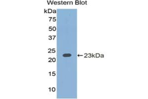 Western blot analysis of the recombinant protein. (IL1A 抗体  (AA 90-268))
