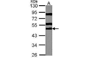 WB Image Sample (30 ug of whole cell lysate) A:NIH-3T3 10% SDS PAGE antibody diluted at 1:1000 (RPS6KB2 抗体  (Center))