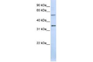 TJAP1 antibody used at 1 ug/ml to detect target protein. (TJAP1 抗体)