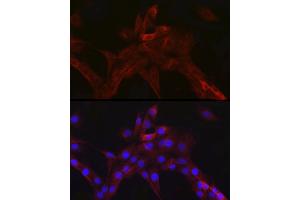 Immunofluorescence analysis of PC-12 cells using nNOS Rabbit mAb (ABIN1680436, ABIN1680435, ABIN7101483 and ABIN7101484) at dilution of 1:100 (40x lens). (NOS1 抗体)