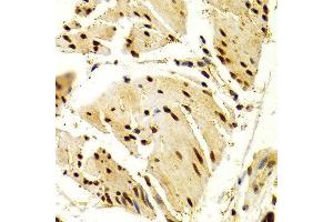 Immunohistochemistry of paraffin-embedded Human esophageal using NFATC1 antibody at dilution of 1:100 (x400 lens). (NFATC1 抗体  (AA 20-300))