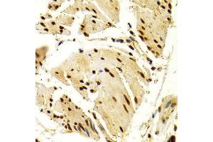 Immunohistochemistry (IHC) image for anti-Nuclear Factor of Activated T-Cells, Cytoplasmic, Calcineurin-Dependent 1 (NFATC1) (AA 20-300) antibody (ABIN3022101)