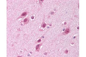 Anti-HUWE1 antibody IHC of human brain, cortex. (HUWE1 抗体  (C-Term))