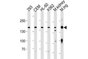Western Blotting (WB) image for anti-Plakophilin 4 (PKP4) antibody (ABIN3004661)