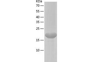 Western Blotting (WB) image for Chromosome 11 Open Reading Frame 34 (C11orf34) (AA 28-218) protein (His tag) (ABIN7288050) (Plet1 Protein (AA 28-218) (His tag))