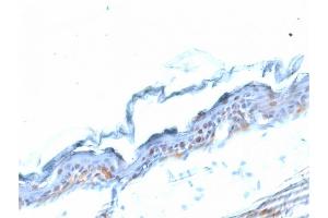 Immunohistochemistry (IHC) image for anti-SRY (Sex Determining Region Y)-Box 2 (SOX2) (AA 176-305) antibody (ABIN6940611)