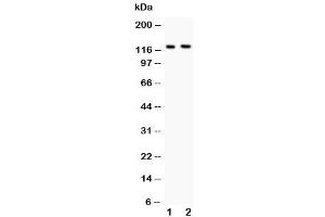 Western blot testing of BOC antibody and Lane 1:  mouse brain (BOC 抗体  (AA 1002-1020))