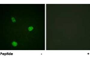 Immunofluorescence analysis of HeLa cells, using MITF polyclonal antibody . (MITF 抗体  (Ser73, Ser180))