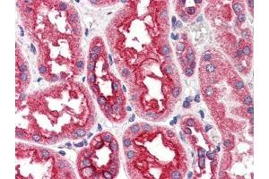 Human Kidney (formalin-fixed, paraffin-embedded) stained with CPT1A antibody at 4 µg/ml followed by biotinylated anti-goat IgG secondary antibody, alkaline phosphatase-streptavidin and chromogen. (CPT1A 抗体  (Internal Region))