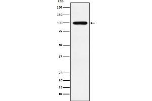 Western blot analysis of Calmegin expression in Jurkat cell lysate.