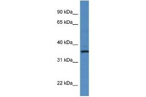 WB Suggested Anti-RIOK1 Antibody Titration: 1. (RIOK1 抗体  (C-Term))