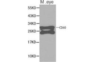 Western Blotting (WB) image for anti-CD40 (CD40) antibody (ABIN1871634) (CD40 抗体)