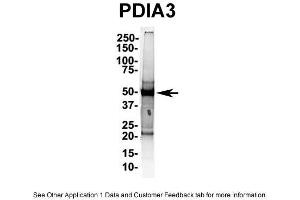 IP Suggested AntiPDIA3 Antibody Positive Control: NT2 CELL/BRAIN TISSUE (PDIA3 抗体  (C-Term))
