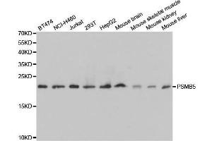 Western blot analysis of extracts of various cell lines, using PSMB5 antibody. (PSMB5 抗体  (AA 1-263))