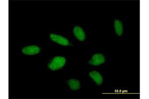 Immunofluorescence of purified MaxPab antibody to TTC23 on HeLa cell. (TTC23 抗体  (AA 1-393))