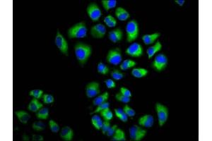 Immunofluorescence staining of Hela cells with ABIN7158207 at 1:166, counter-stained with DAPI. (LRIG2 抗体  (AA 833-932))