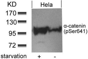 Western blot analysis of extracts from Hela cells untreated or treated with starvation using a-catenin(Phospho-Ser641) antibody. (CTNNA1 抗体  (pSer641))