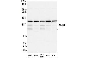 Western Blotting (WB) image for anti-serologically Defined Colon Cancer Antigen 1 (SDCCAG1) (AA 725-775) antibody (ABIN7452570)