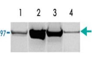 (1) Rat liver homogenate (50 ug of total protein). (PYGM 抗体)