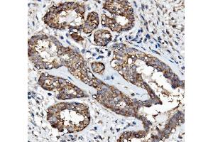 IHC analysis of EGFR using anti-EGFR antibody (ABIN7601478). (EGFR 抗体  (AA 36-497))