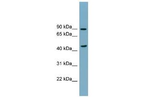 WB Suggested Anti-SMPD2 Antibody Titration:  0. (SMPD2 抗体  (N-Term))