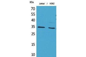 Western Blot (WB) analysis of Jurkat, K562 cells using Acetyl-Ref-1 (K7) Polyclonal Antibody. (APEX1 抗体  (acLys7))