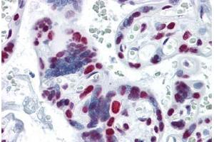 Human Placenta: Formalin-Fixed, Paraffin-Embedded (FFPE) (HNRNPM 抗体  (AA 17-113))