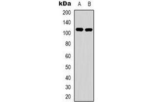 Western blot analysis of EPHA1 expression in Hela (A), HepG2 (B) whole cell lysates.