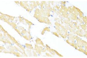 Immunohistochemistry of paraffin-embedded Rat heart using UQCC2 Polyclonal Antibody at dilution of 1:100 (40x lens). (MNF1 抗体)