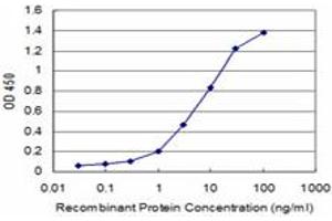 Detection limit for recombinant GST tagged HOXB7 is approximately 0. (HOXB7 抗体  (AA 55-120))