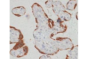 Immunohistochemistry of paraffin-embedded Human placenta using SARS2 Polyclonal Antibody at dilution of 1:100 (40x lens). (SARS2 抗体)